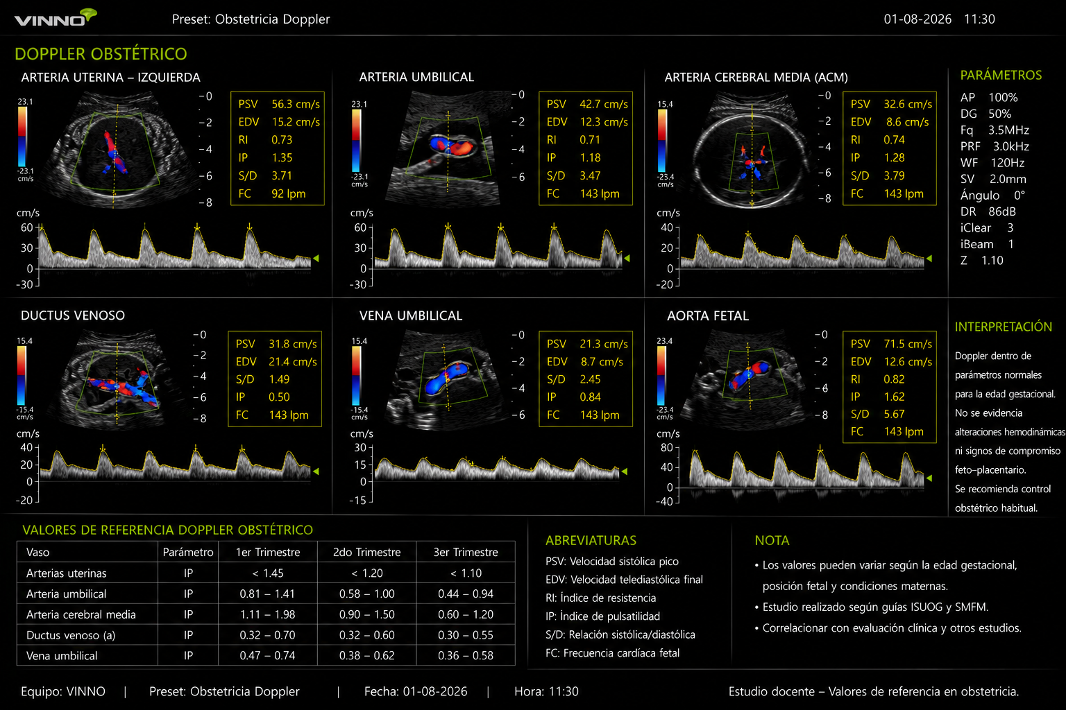 Doppler obstétrico