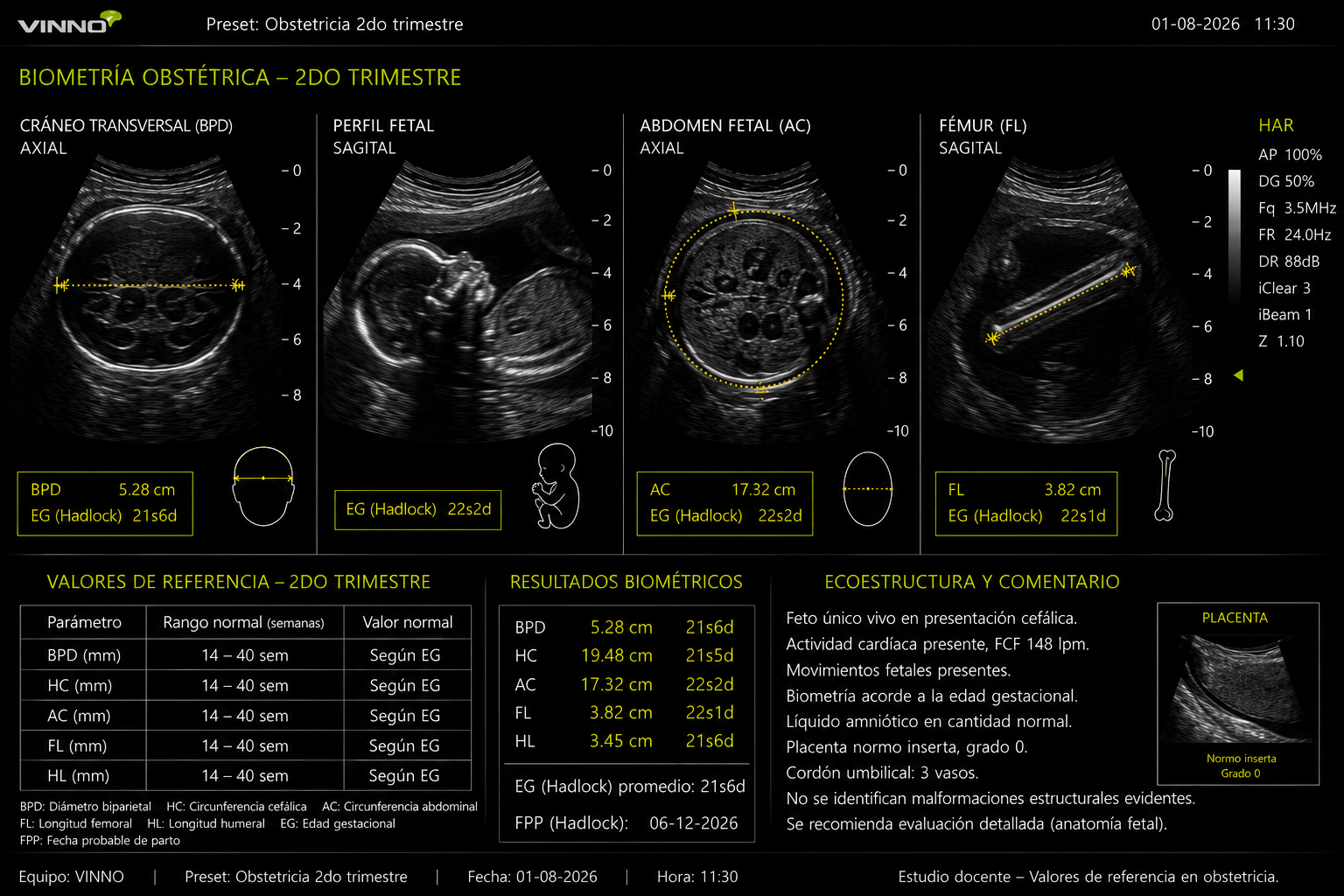 Biometría de primer trimestre