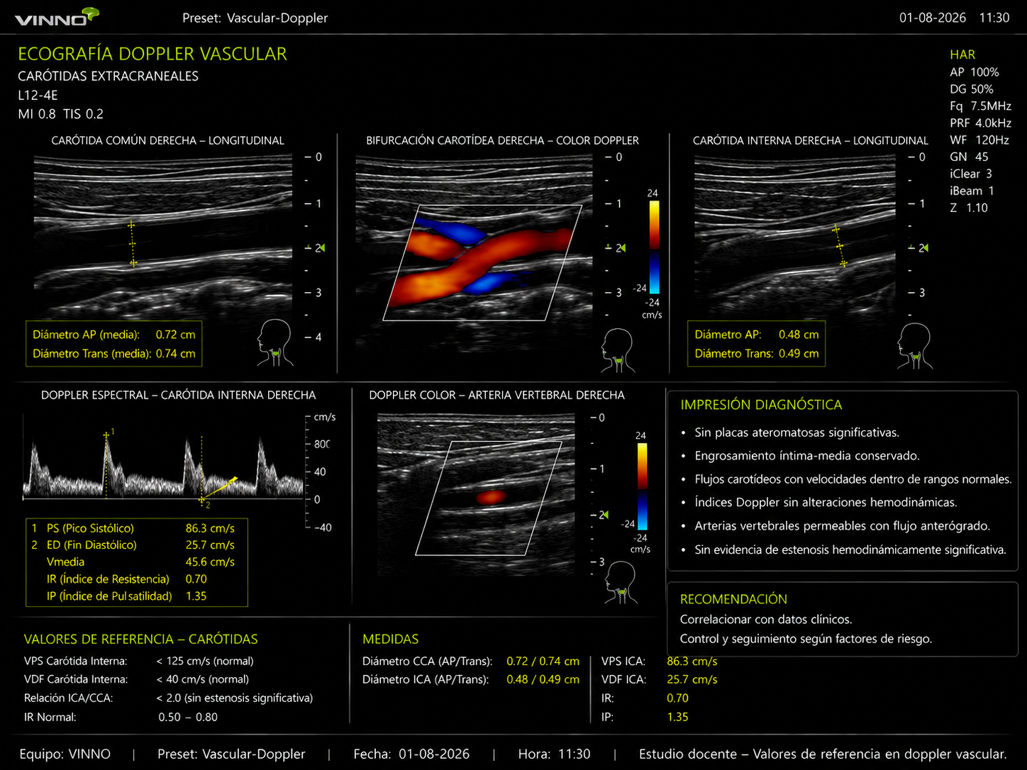 Doppler vascular